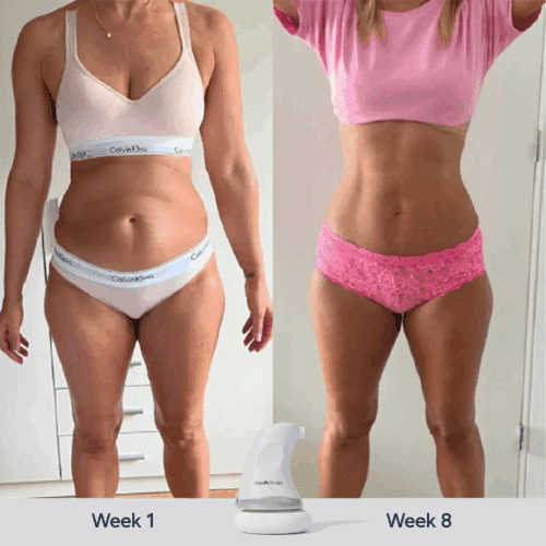 Nordic Sculpt Before and After